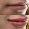 Lips case #10049
