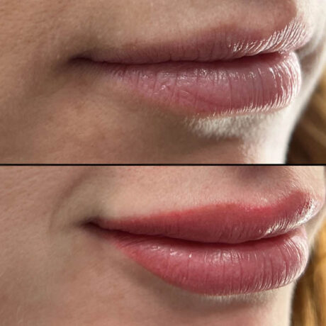 Lips case #10049