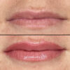 Lips case #10051