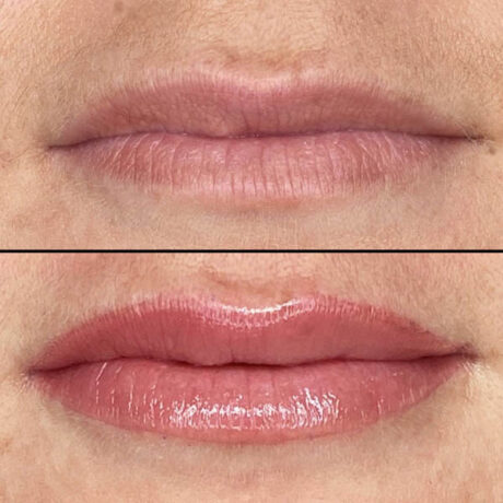 Lips case #10051