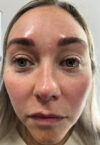 Brow case #10016
