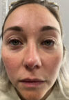 Brow case #10016