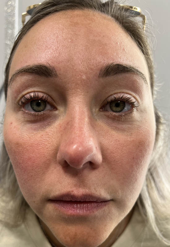 Brow case #10016