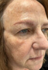 Brow case #10019