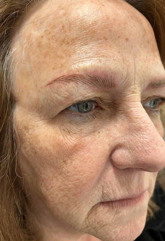 Brow case #10019