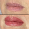 Lips case #10059