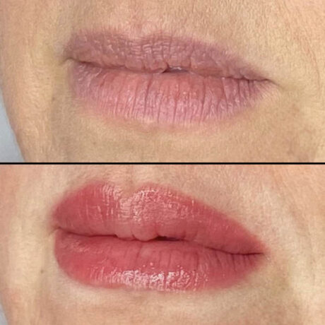 Lips case #10059