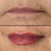 Lips case #10061