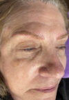 Brow case #10025