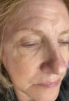 Brow case #10025