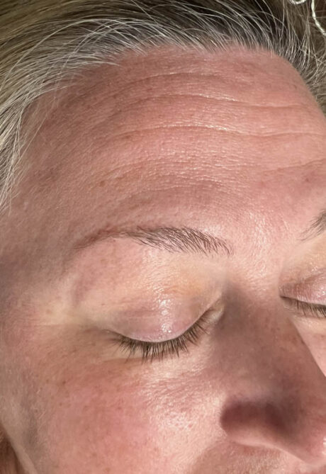 Brow case #10028