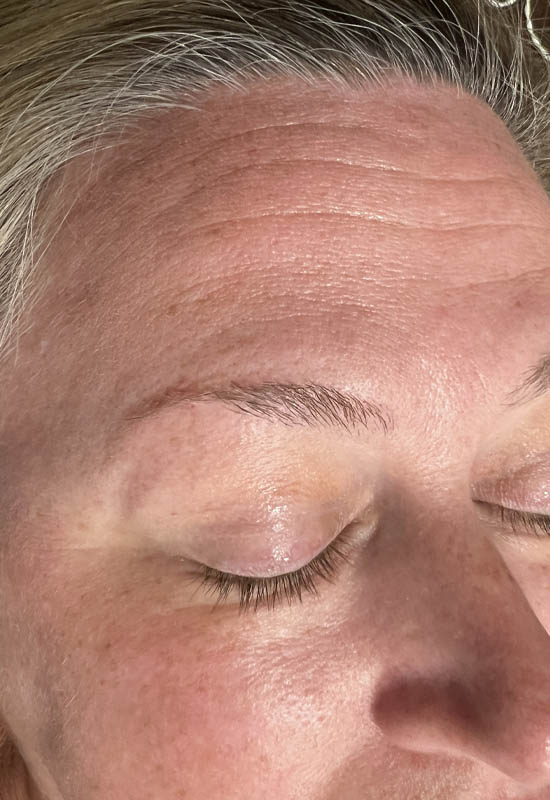 Brow case #10028
