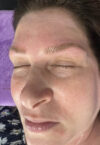 Brow case #10034