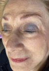 Brow case #10037