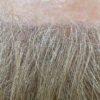 Scalp Micropigmentation case #10085