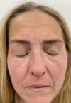 Brow case #10043