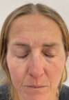 Brow case #10043