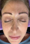 Brow case #10046