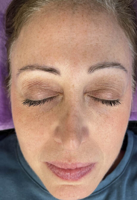 Brow case #10046